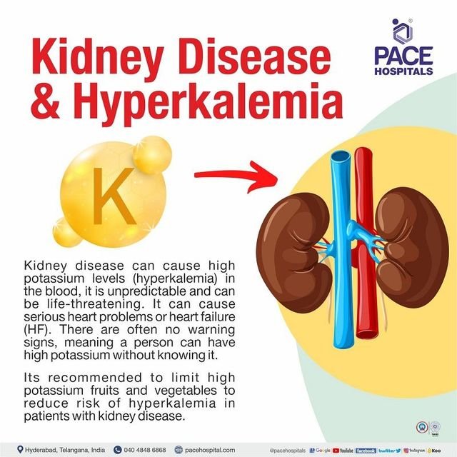 potassium-and-kidney-stones-a-balancing-act-oxalate-facts