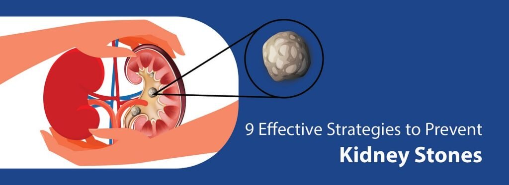 Kidney Stones And Mental Well-Being: Strategies For Prevention