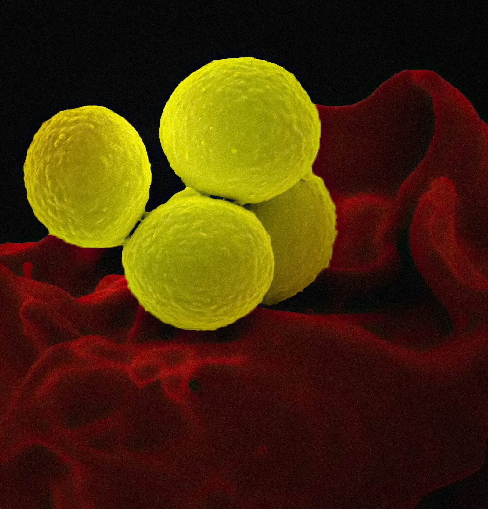 How Hormones May Influence Oxalate Sensitivity